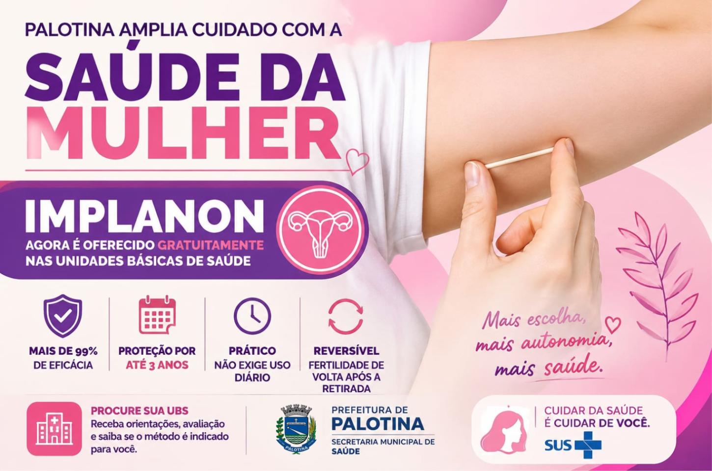Palotina amplia cuidado com a saúde da mulher e passa a oferecer Implanon gratuitamente nas UBSs